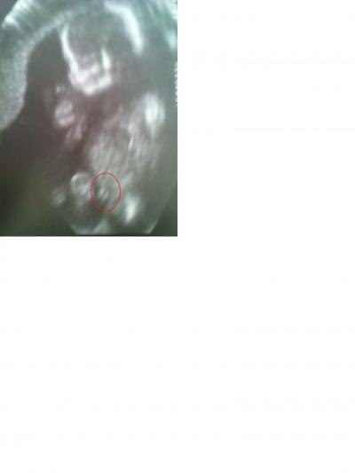 Bild zu US Bild Junge oder Mädchen? was würdet ihr sagen? - Forum für August - Mamis