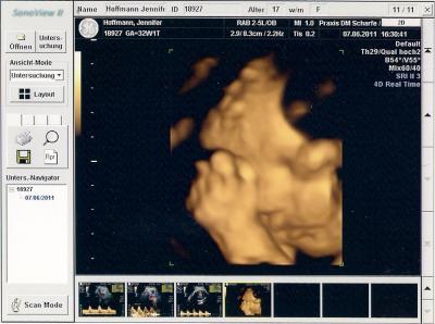 Bild zu zurück vom frauenarzt - Forum für August - Mamis