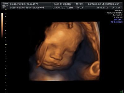 Bild zu Möchte mich auch mal vorstellen... - Forum für August - Mamis