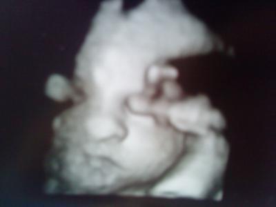 Bild zu Meine kleine Prinzessin bei 31+0 - Forum für August - Mamis