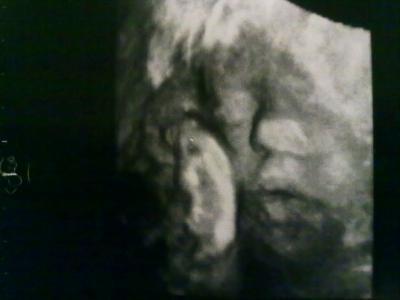 Bild zu Ich bin soooo verliebt! - Forum für August - Mamis