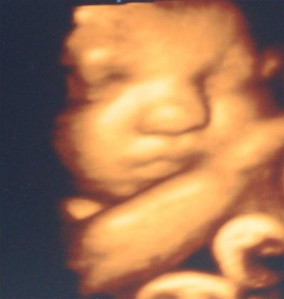 Bild zu Meine kleine Maus... - Forum für August - Mamis