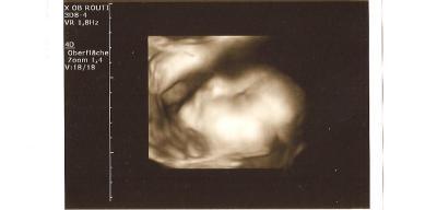 Bild zu Heute VU mit Bildchen :))) - Forum für August - Mamis