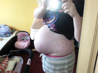 Bild zu bauchbilder - Forum für August - Mamis