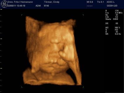 Bild zu Möchte euch mal unser Baby zeigen :) - Forum für August - Mamis