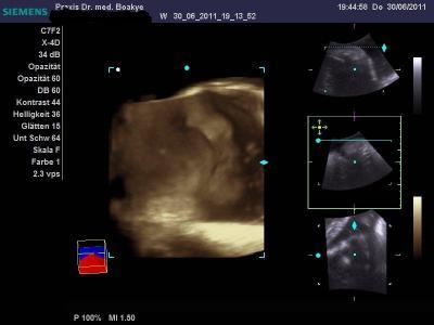 Bild zu 3 D Bild - Forum für August - Mamis
