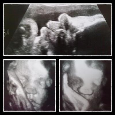 Bild zu Mein kleiner BauchWicht - Forum für August - Mamis