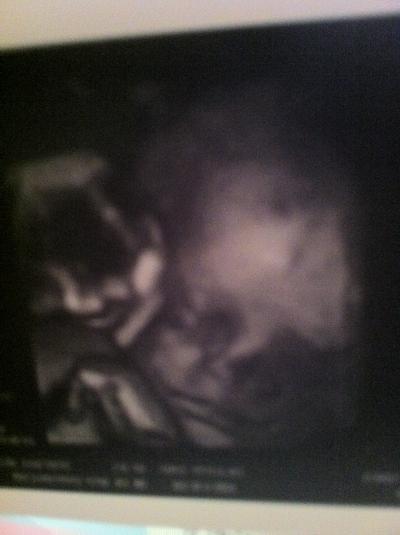 Bild zu mein baby in der 30. ssw - Forum für August - Mamis