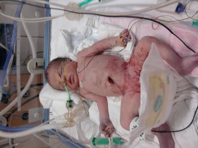 Bild zu Sorry, sehr schlechte Nachrichten! - Forum für August - Mamis