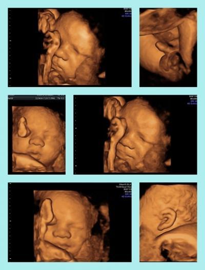 Bild zu 3d ultraschall war sehr erfolgreich :o) - Forum für August - Mamis