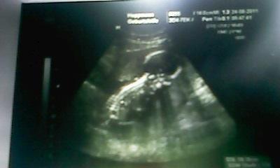 Bild zu War Heute beim FA.... wie Groß sind eure Würmchen jetzt? - Forum für August - Mamis