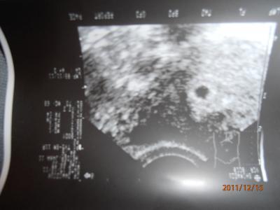 Bild zu US bild...... - Forum für August - Mamis