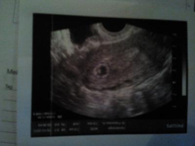 Bild zu Krankenhaus - Forum für August - Mamis