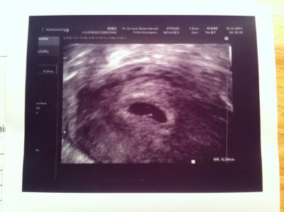 Bild zu Mein US Bild sieht irgenwie anders aus als euers... - Forum für August - Mamis