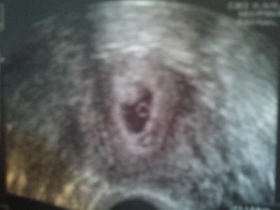 Bild zu ultraschallbild - Forum für August - Mamis