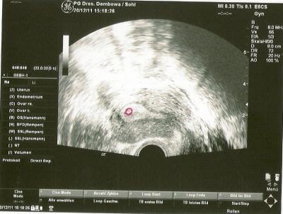 Bild zu Vom 1. FA Termin zurück - Forum für August - Mamis