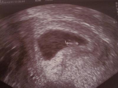 Bild zu Zurück vom Doc! - Forum für August - Mamis