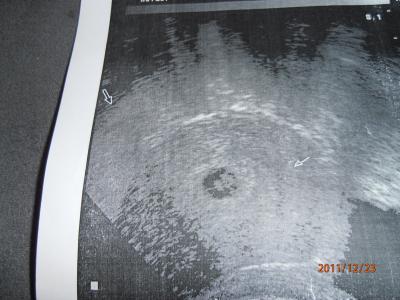 Bild zu US bild.....aber jetzt - Forum für August - Mamis