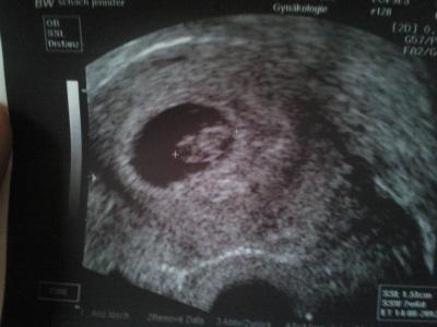 Bild zu alles in Ordnung - Forum für August - Mamis