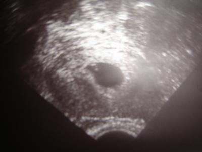 Bild zu Ich hab euch meinen Krümmel... - Forum für August - Mamis