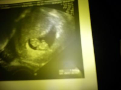 Bild zu Hallo Ihr - Forum für August - Mamis