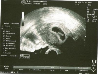 Bild zu Zurück vom FA - Forum für August - Mamis