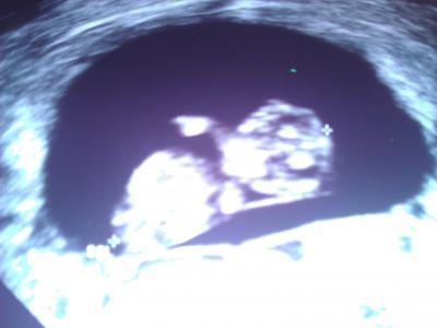 Bild zu Hatte heute erstes Screening..... - Forum für August - Mamis