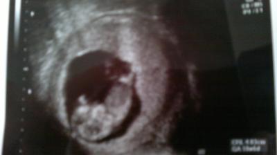 Bild zu ich bin soooo verliebt - Forum für August - Mamis