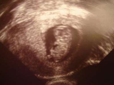 Bild zu Zurück vom Fa! - Forum für August - Mamis