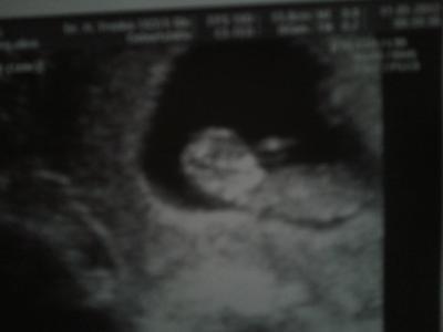 Bild zu Zurueck vom FA! Mit Foto ;-) - Forum für August - Mamis