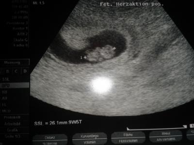 Bild zu Mein Gummibärchen - Forum für August - Mamis