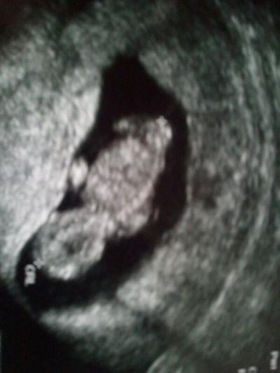 Bild zu war gestern im KH - Forum für August - Mamis