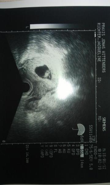 Bild zu ich bleibe bei euch - Forum für August - Mamis