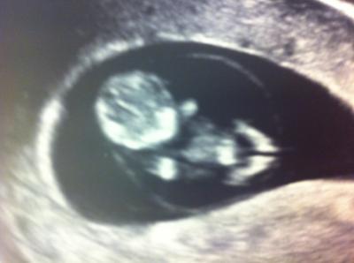 Bild zu Wie versprochen mein US Bild von gestern... - Forum für August - Mamis