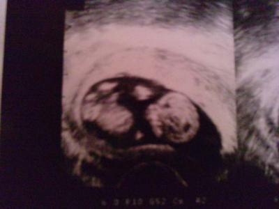 Bild zu Zurück vom FA - Forum für August - Mamis