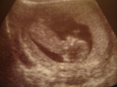 Bild zu Zurück vom Fa - Forum für August - Mamis