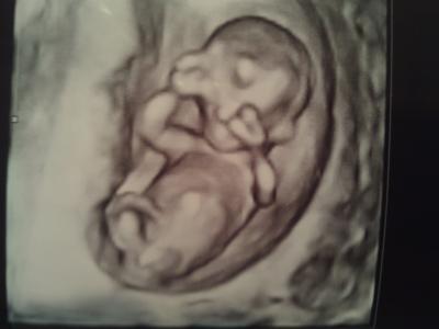 Bild zu Wieder da vom Arzt......... schaut mal...... - Forum für August - Mamis