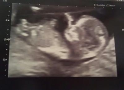 Bild zu wieder da und... - Forum für August - Mamis