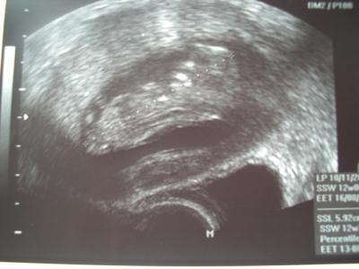 Bild zu Zurück vom Doc :D - Forum für August - Mamis