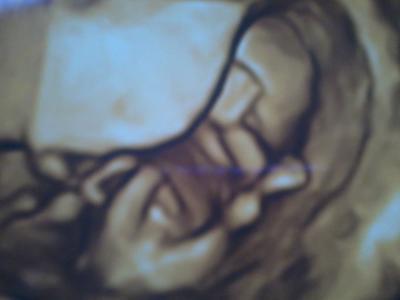 Bild zu Auch gute Nachrichten - NF völlig unbedenklich! - Forum für August - Mamis