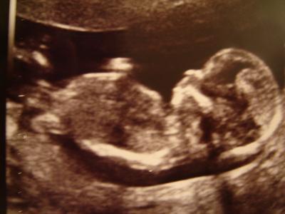 Bild zu Hier bin ich ihr Lieben! - Forum für August - Mamis