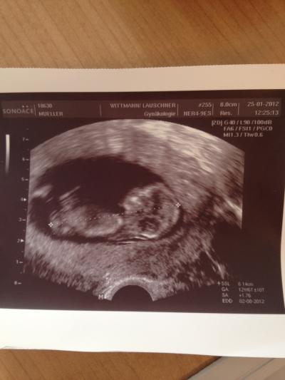 Bild zu Mein Baby - Forum für August - Mamis