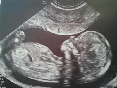 Bild zu Bin zurück mit Foto im Gepäck ;) - Forum für August - Mamis