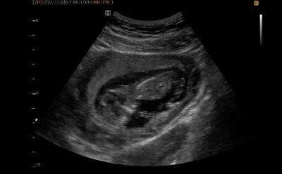 Bild zu Zurück vom FA :-) - Forum für August - Mamis