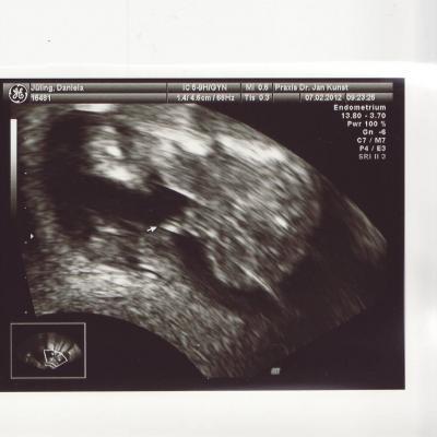 Bild zu Zurück vom FA... - Forum für August - Mamis