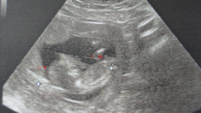 Bild zu Ein Foto von unserem Zwergal :) - Forum für August - Mamis