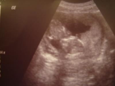 Bild zu Zurück vom Fa - Forum für August - Mamis