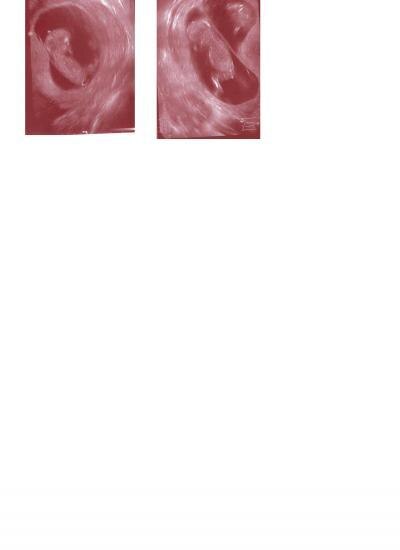 Bild zu zwillinge 13.ssw - Forum für August - Mamis