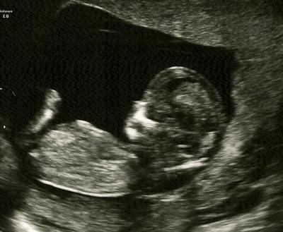 Bild zu Bildchen von NF-Messung :-) Alles gut!!! - Forum für August - Mamis