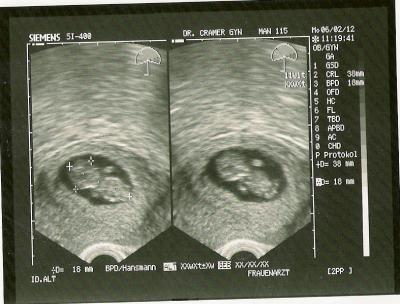 Bild zu Bilder runde wer macht mit??? - Forum für August - Mamis